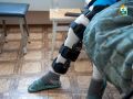 В Ненецкой окружной больнице за неделю проведут 40 операций на крупных суставах