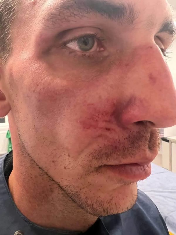 Анатолий Кузичев: В Польше продолжают мутузить украинцев за мову Анатолий Кузичев: В Польше продолжают мутузить украинцев за мову