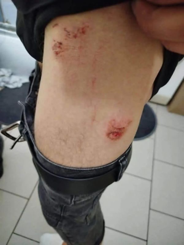 Анатолий Кузичев: В Польше продолжают мутузить украинцев за мову Анатолий Кузичев: В Польше продолжают мутузить украинцев за мову